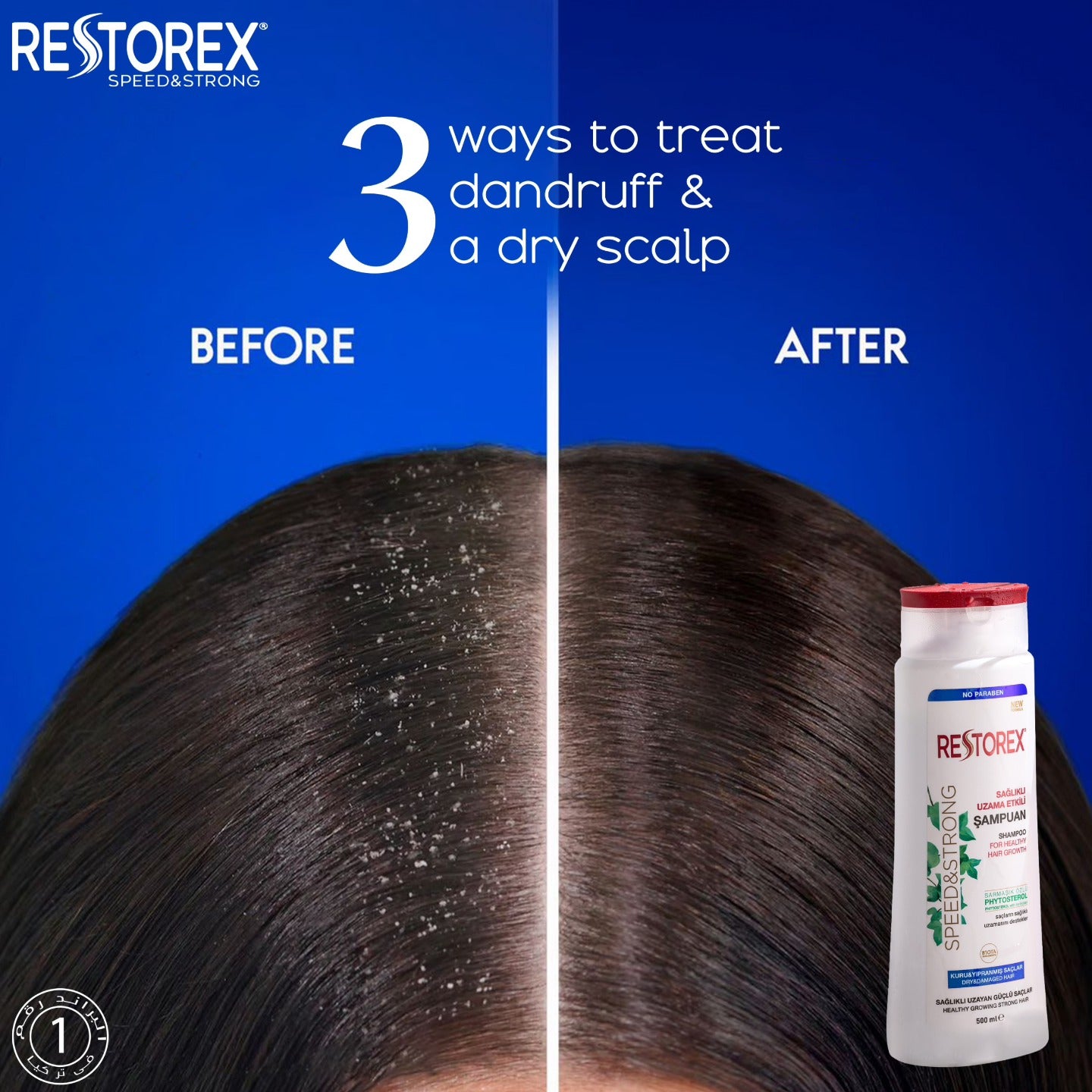 Restorex Speed & Strong Shampoo for healthy hair growth Anti Dandruff   شامبو ريسنوريكس ضد القشرة 500 ملي